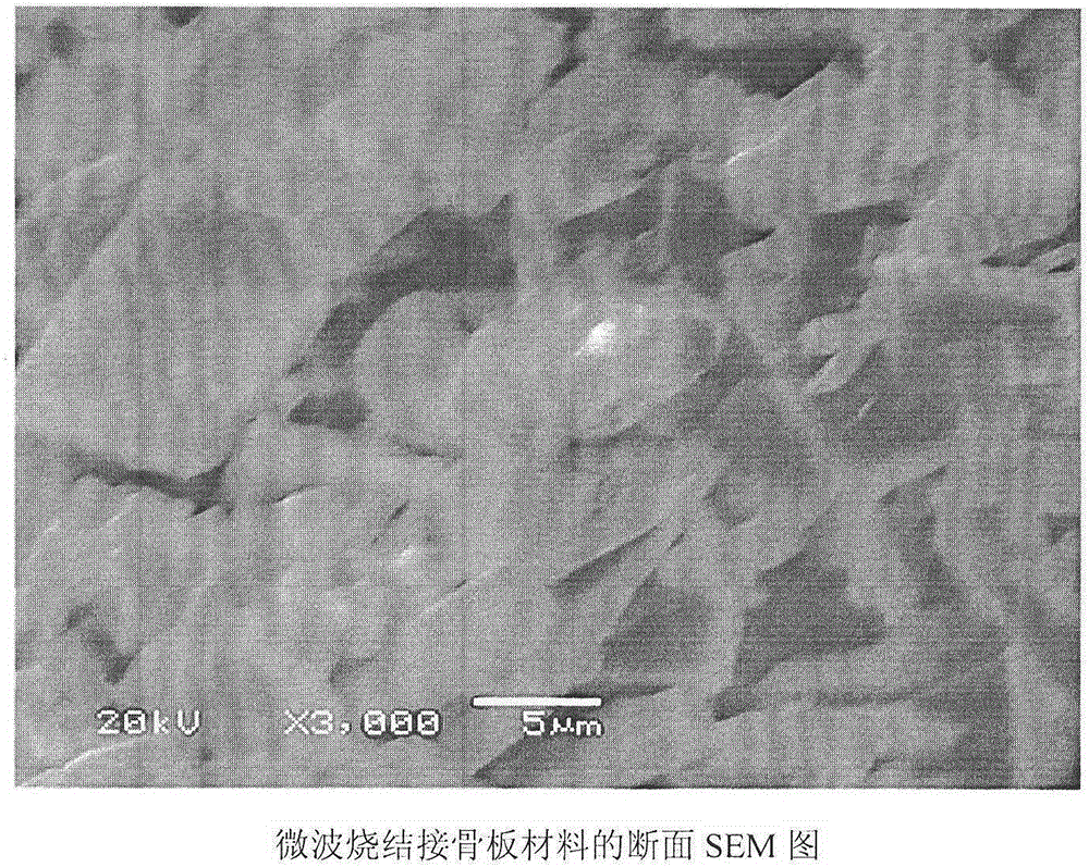 Method for low-cost industrialized preparation of recoverable degradable calcium phosphate bone fracture plate