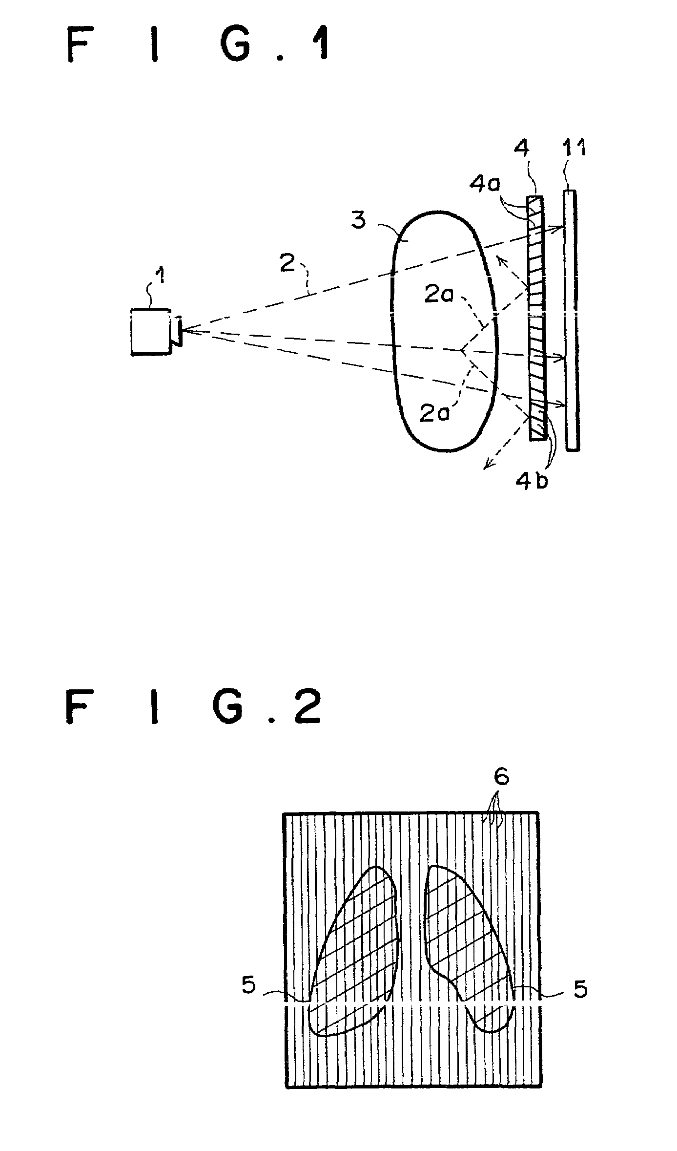 Method and unit for suppressing a periodic pattern