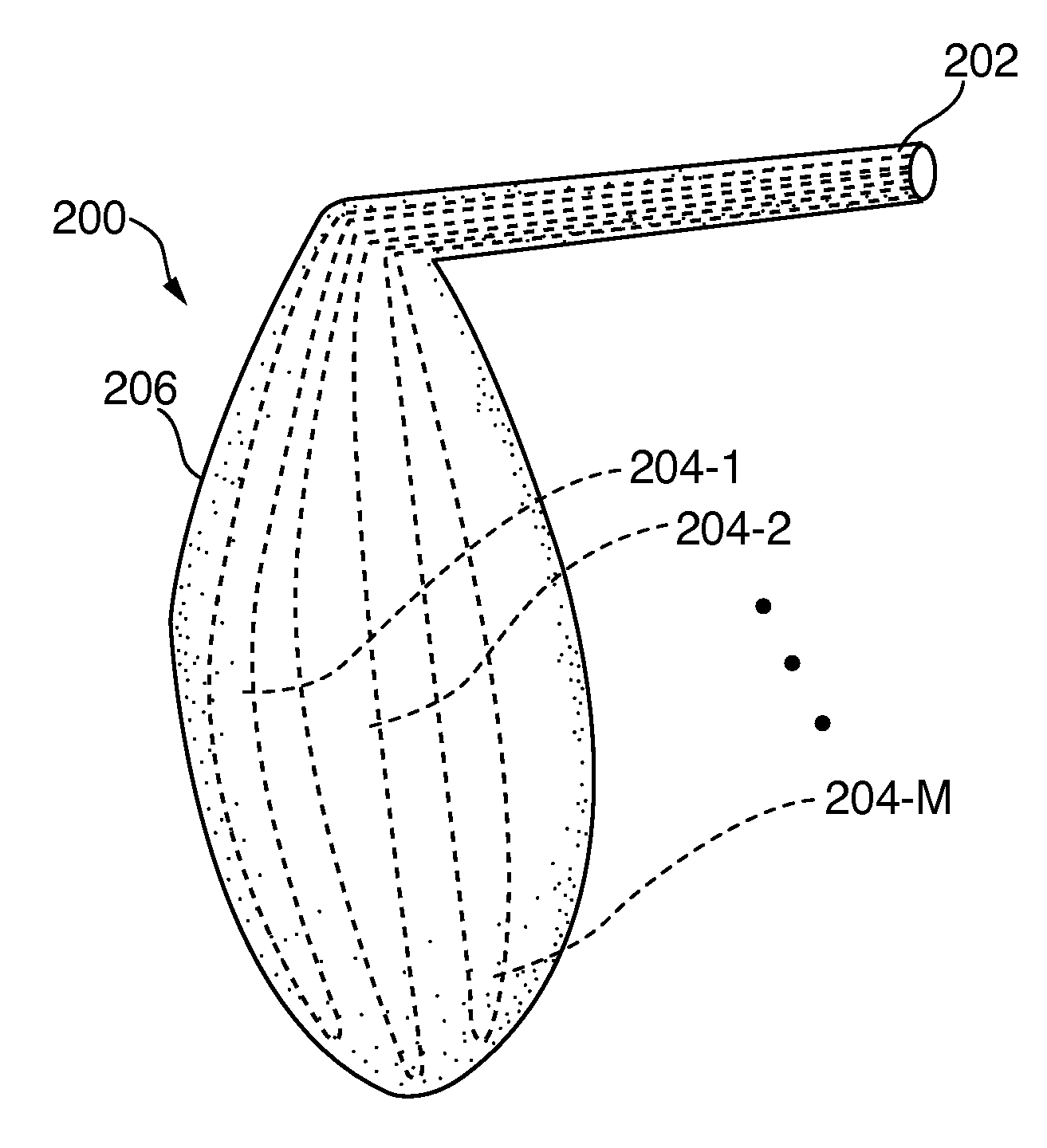 Small Incision, Customizable Specific Gravity Prosthesis