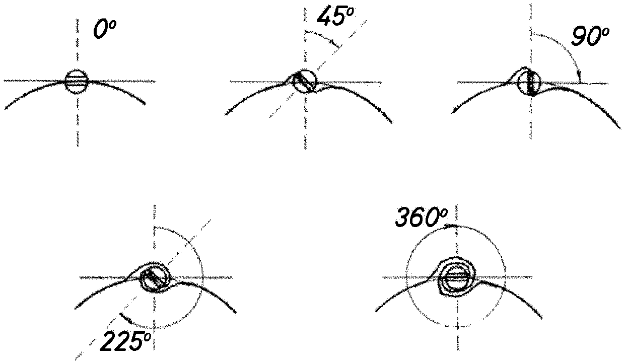 Device To Adjust A Strip Of Circular Adjustment Around The Cephalic Pole