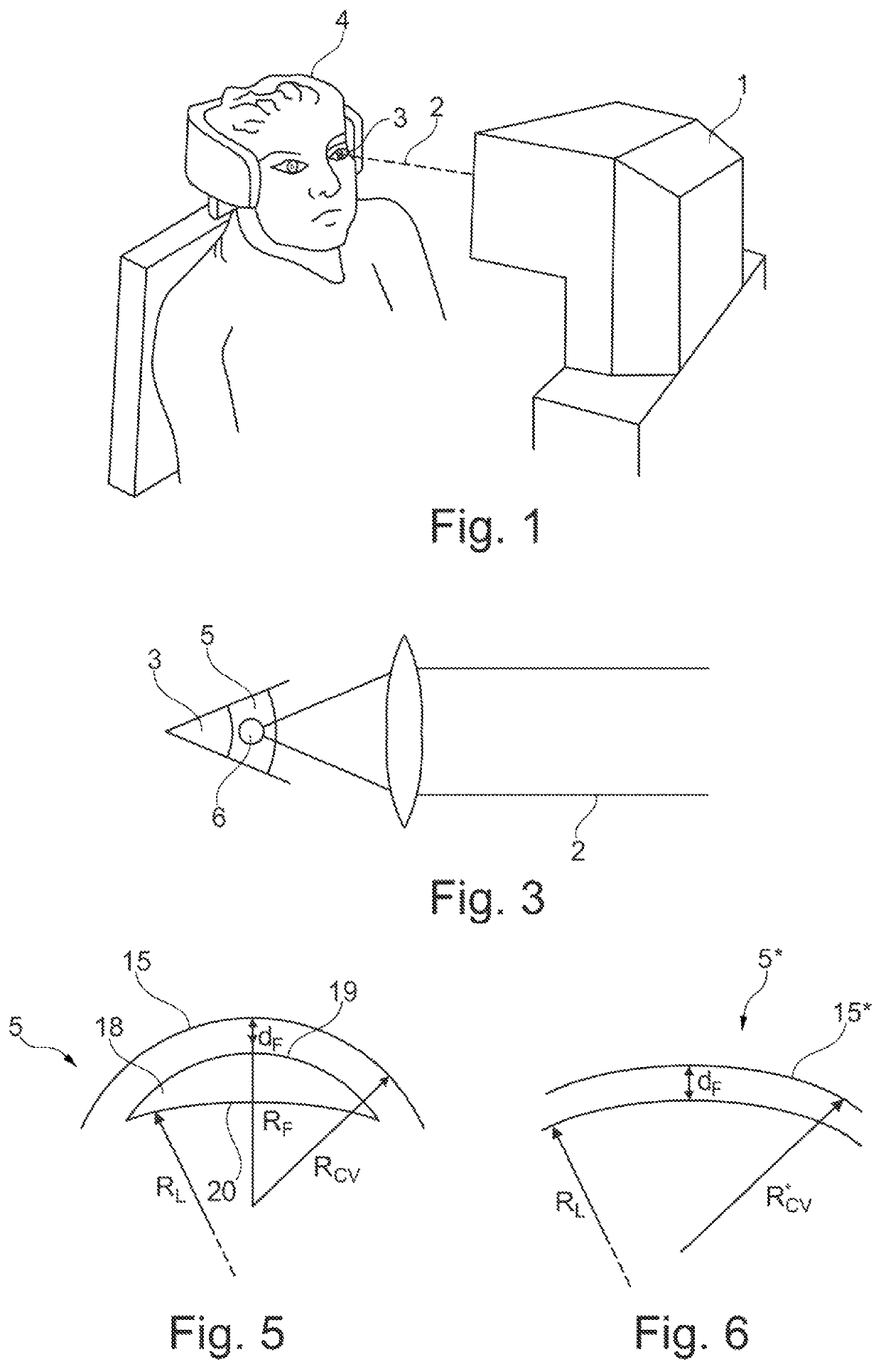 Device for surgically correcting ametropia of an eye and method for creating control data therefor