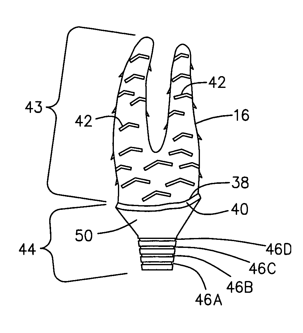 Dental implant and method for making and installing same