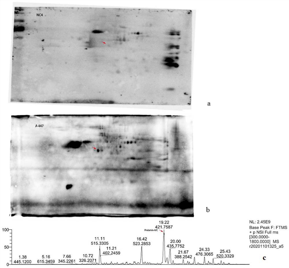 Kit for detecting anti-Pelamin A/C-IgG antibody