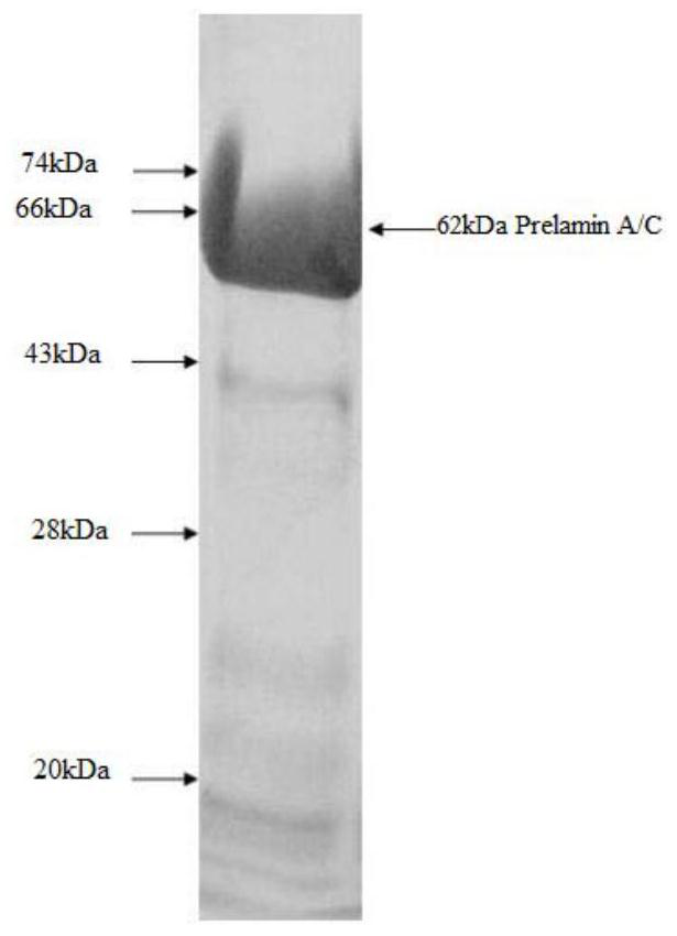 Kit for detecting anti-Pelamin A/C-IgG antibody