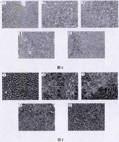 Glycyrrhizin arginine salt and preparation method and application thereof