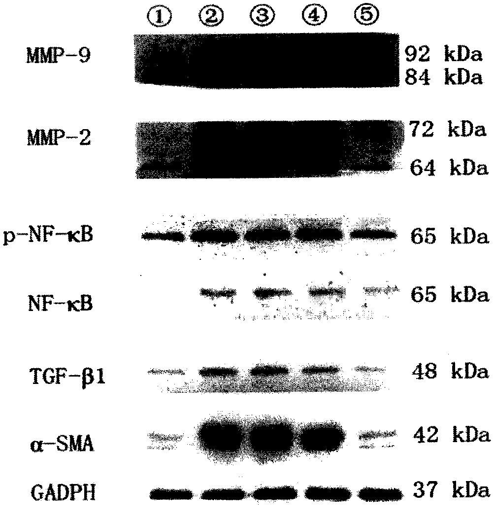 Glycyrrhizin arginine salt and preparation method and application thereof