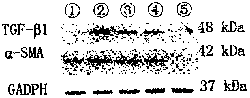 Glycyrrhizin arginine salt and preparation method and application thereof