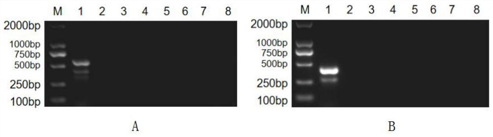 Nested PCR (polymerase chain reaction) primer group for simultaneously detecting mycoplasma hyopneumoniae and swine chlamydiosis and application of nested PCR primer group