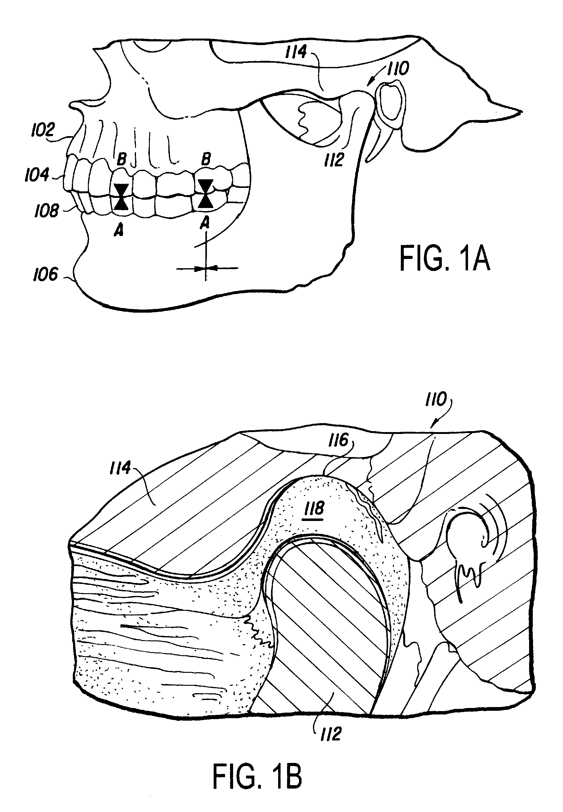 Musculoskeletal repositioning device