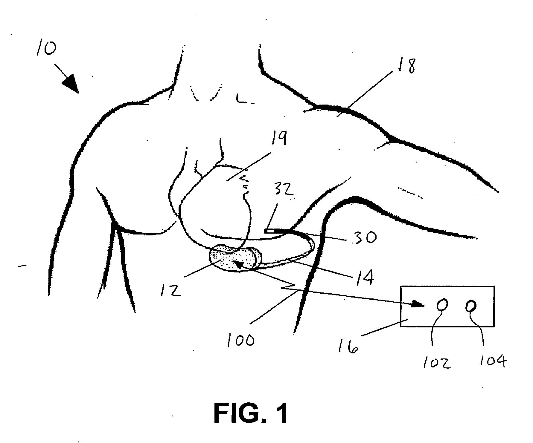 Method and system for aborting cardiac treatments