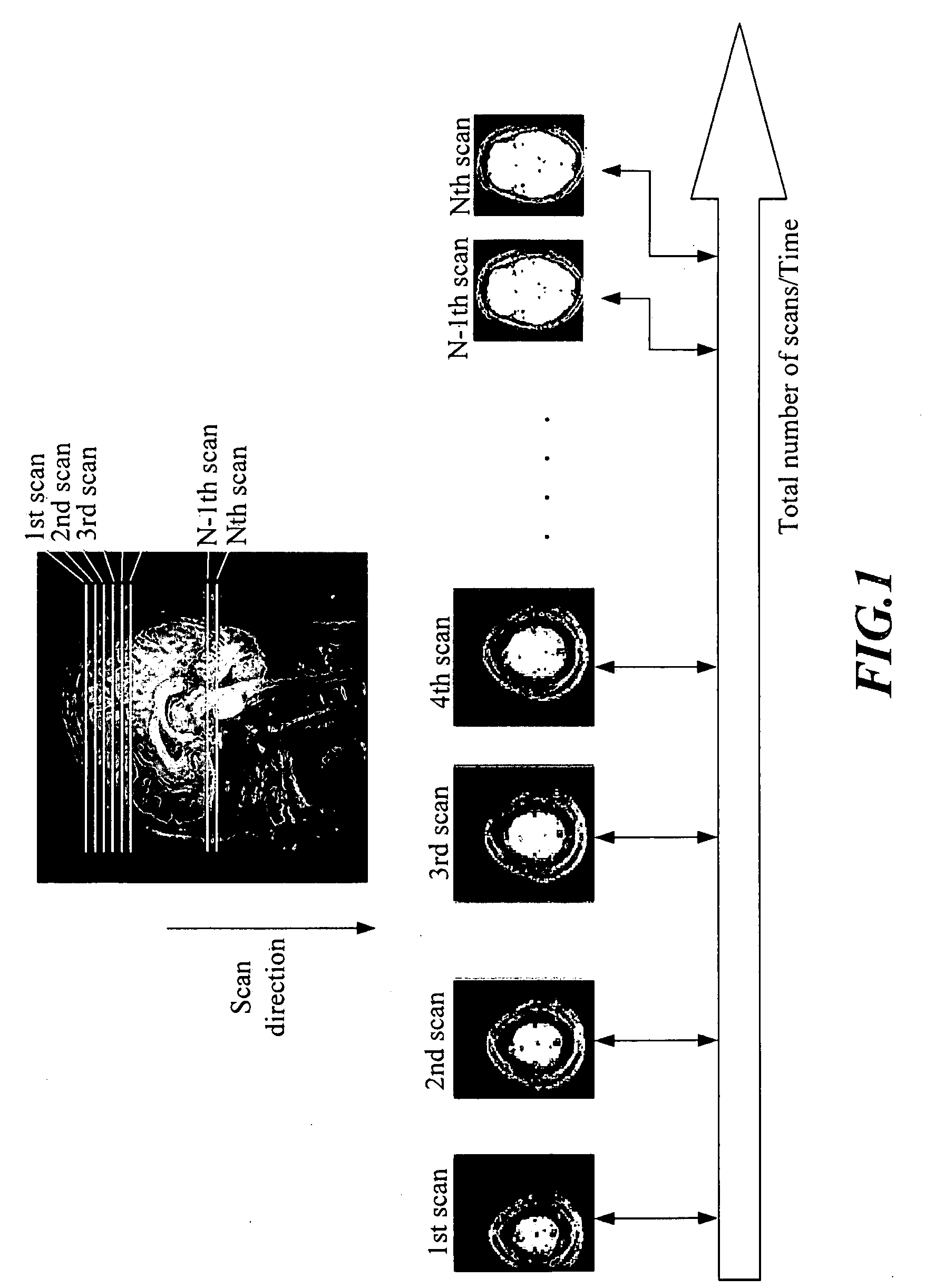 Method and apparatus for simultaneously acquiring multiple slices/slabs in magnetic resonance system