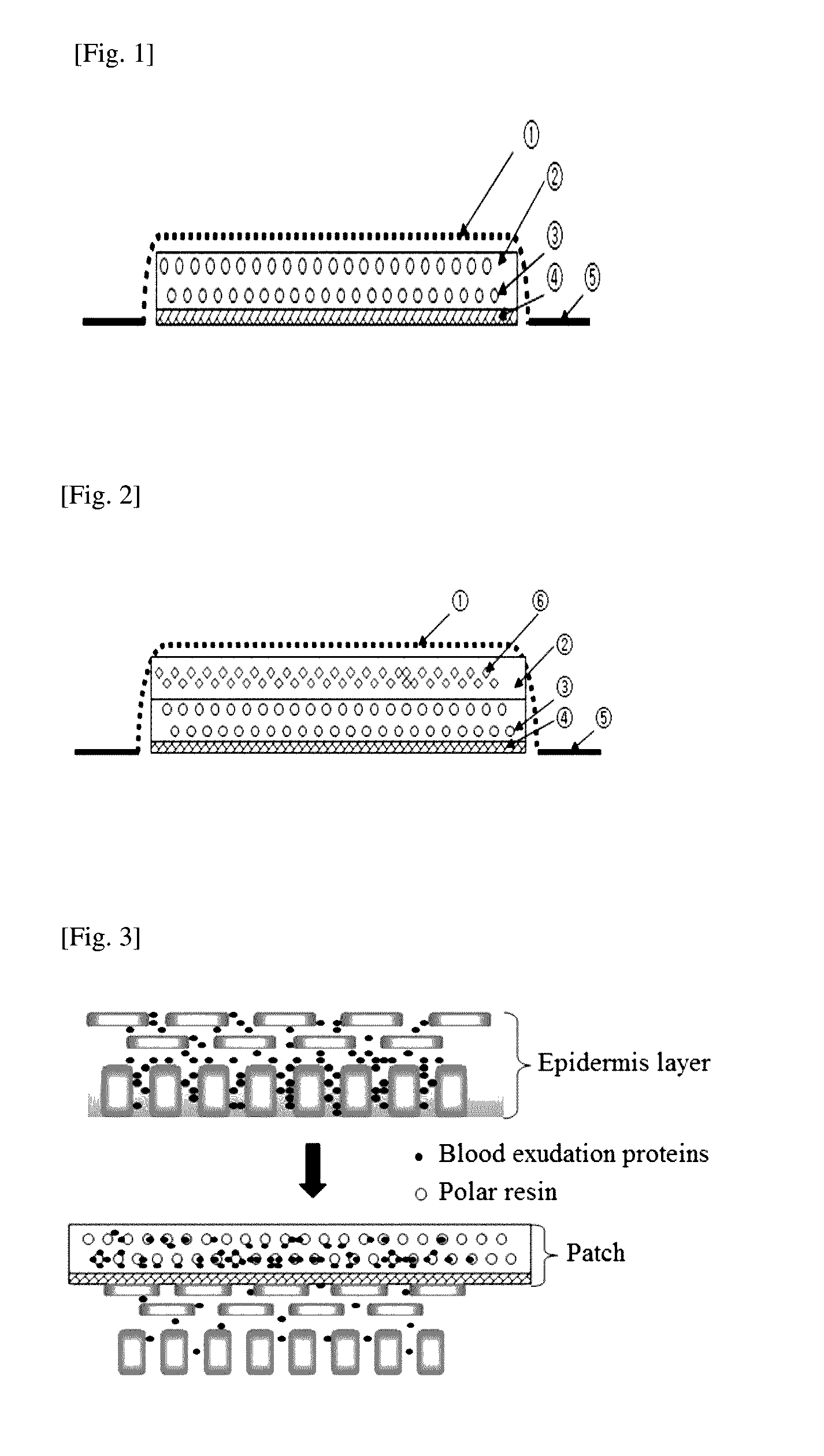 Patch for treating and alleviating symptoms of skin diseases accompanied by effusion of blood proteins