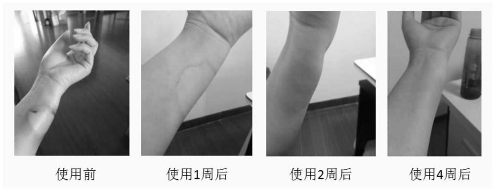 A kind of skin repairing composition and its preparation method and application
