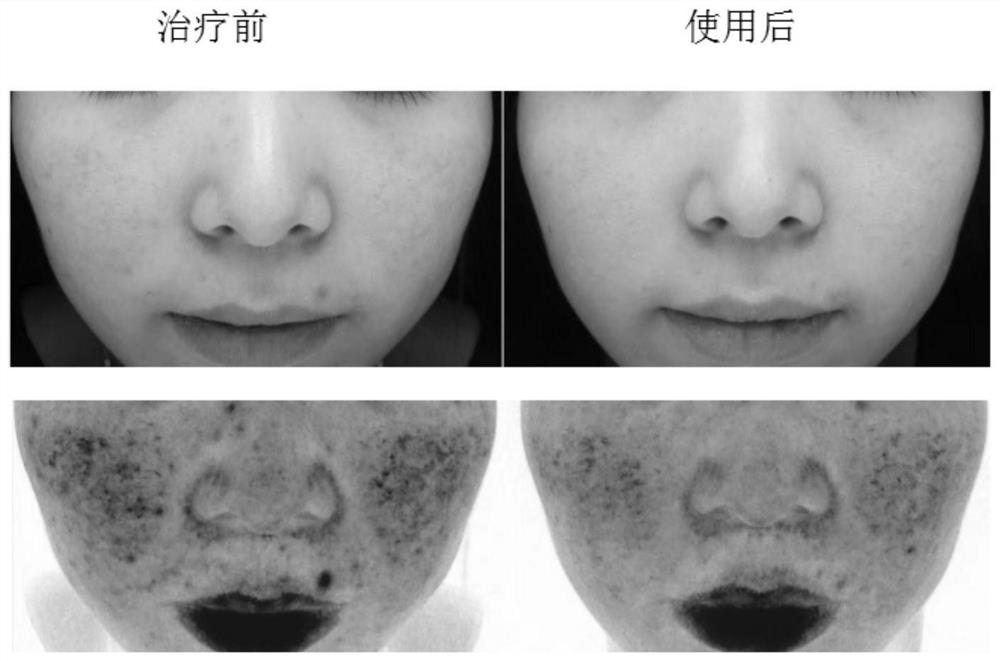 A kind of skin repairing composition and its preparation method and application