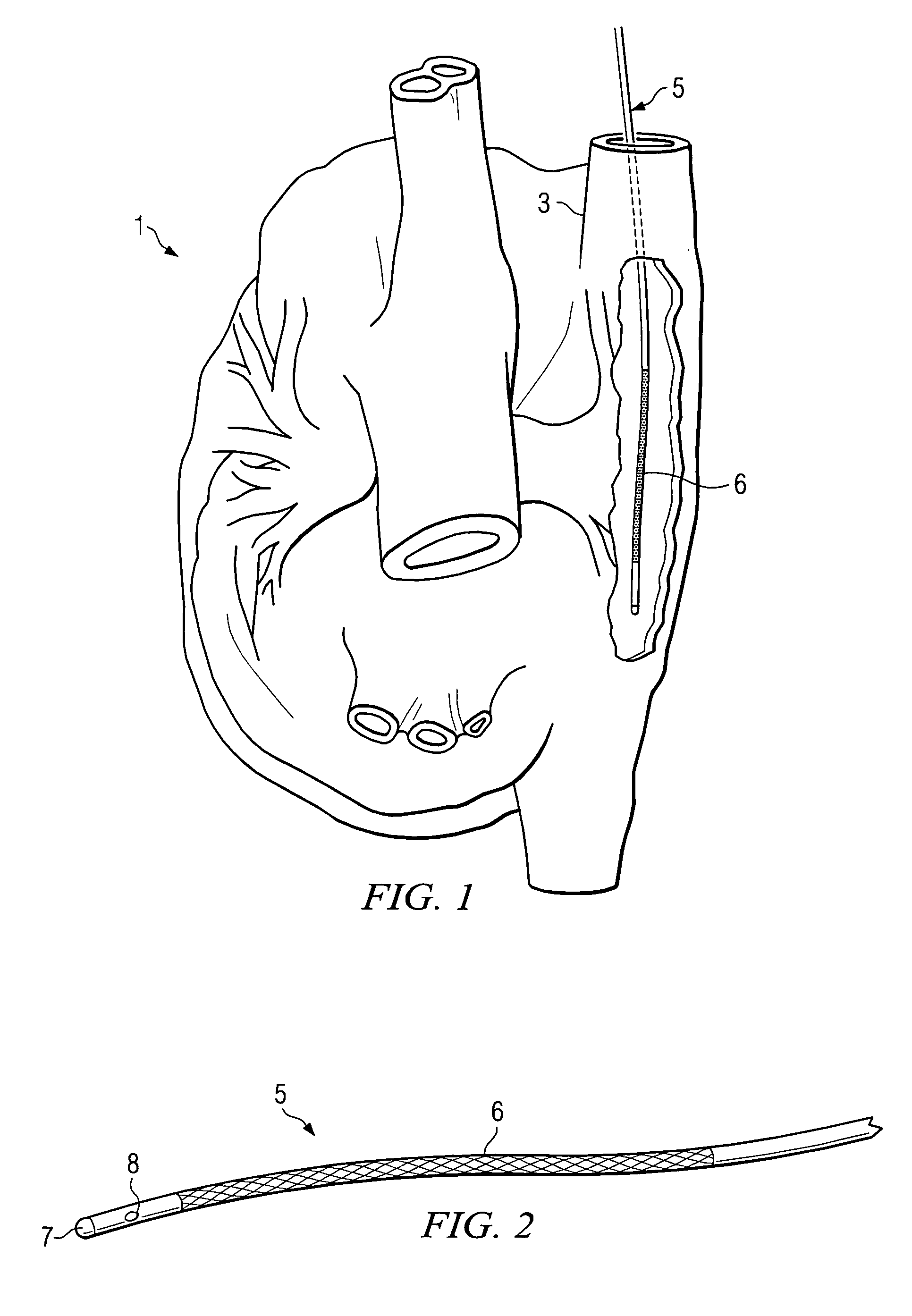 Apparatus and method for guiding catheters