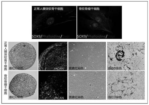 Primary isolation culture method of condylar cartilage stem cells