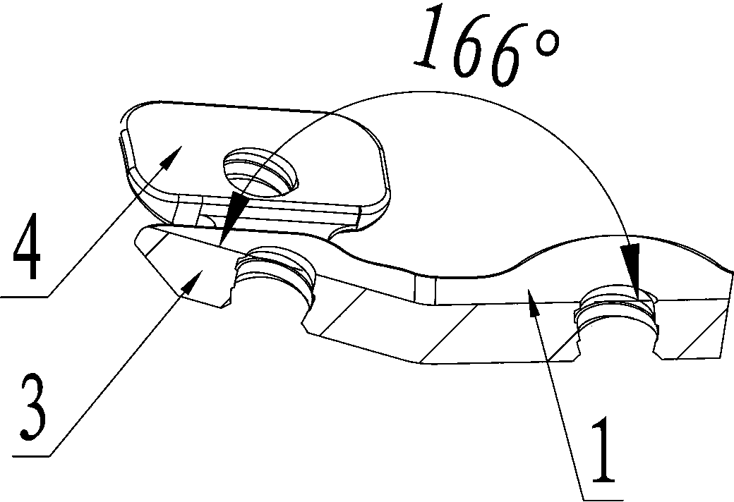 N-shaped locking palm dorsal bone plate