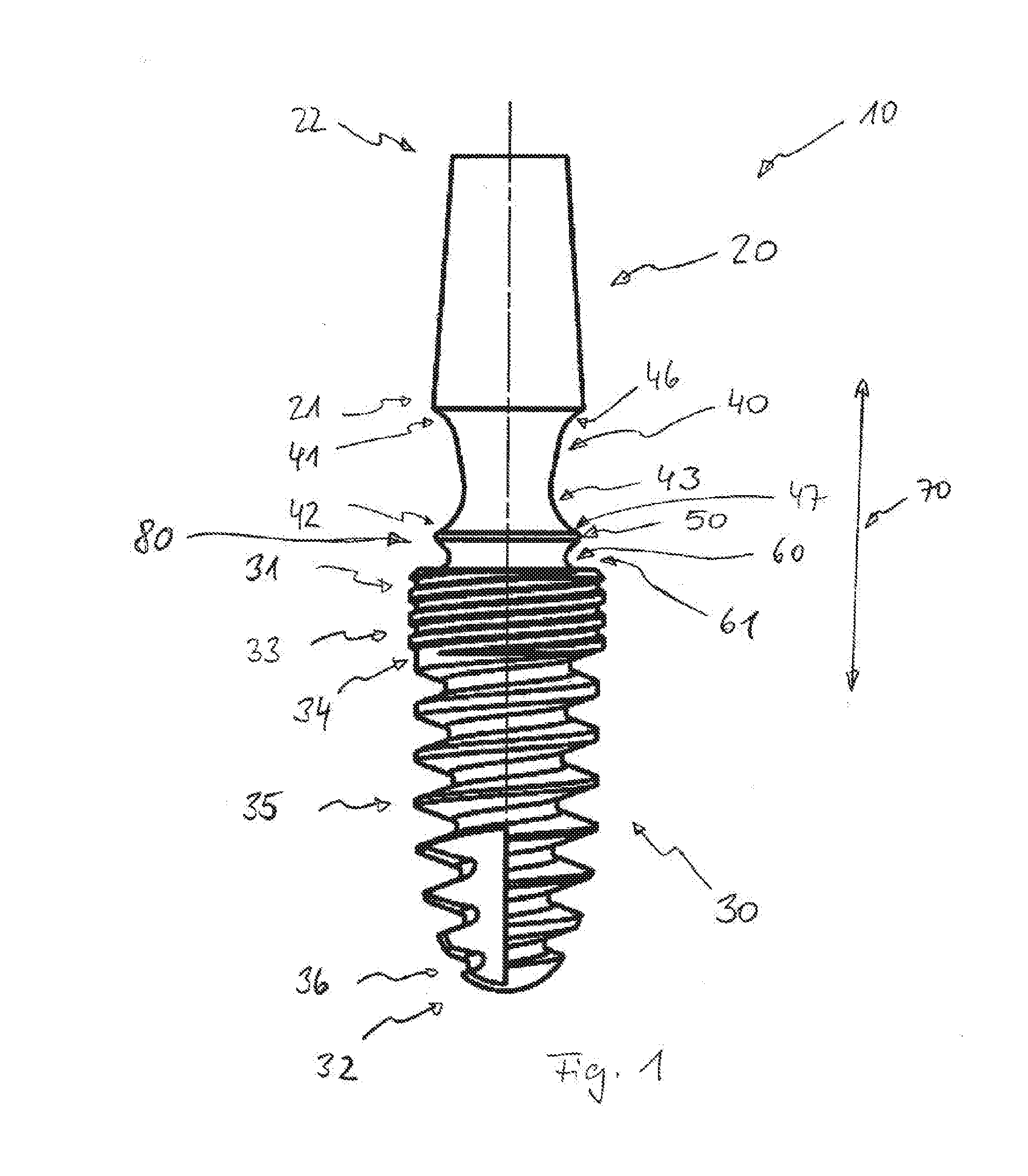 One-part tooth implant, device for bending an implant, and method for bending an implant