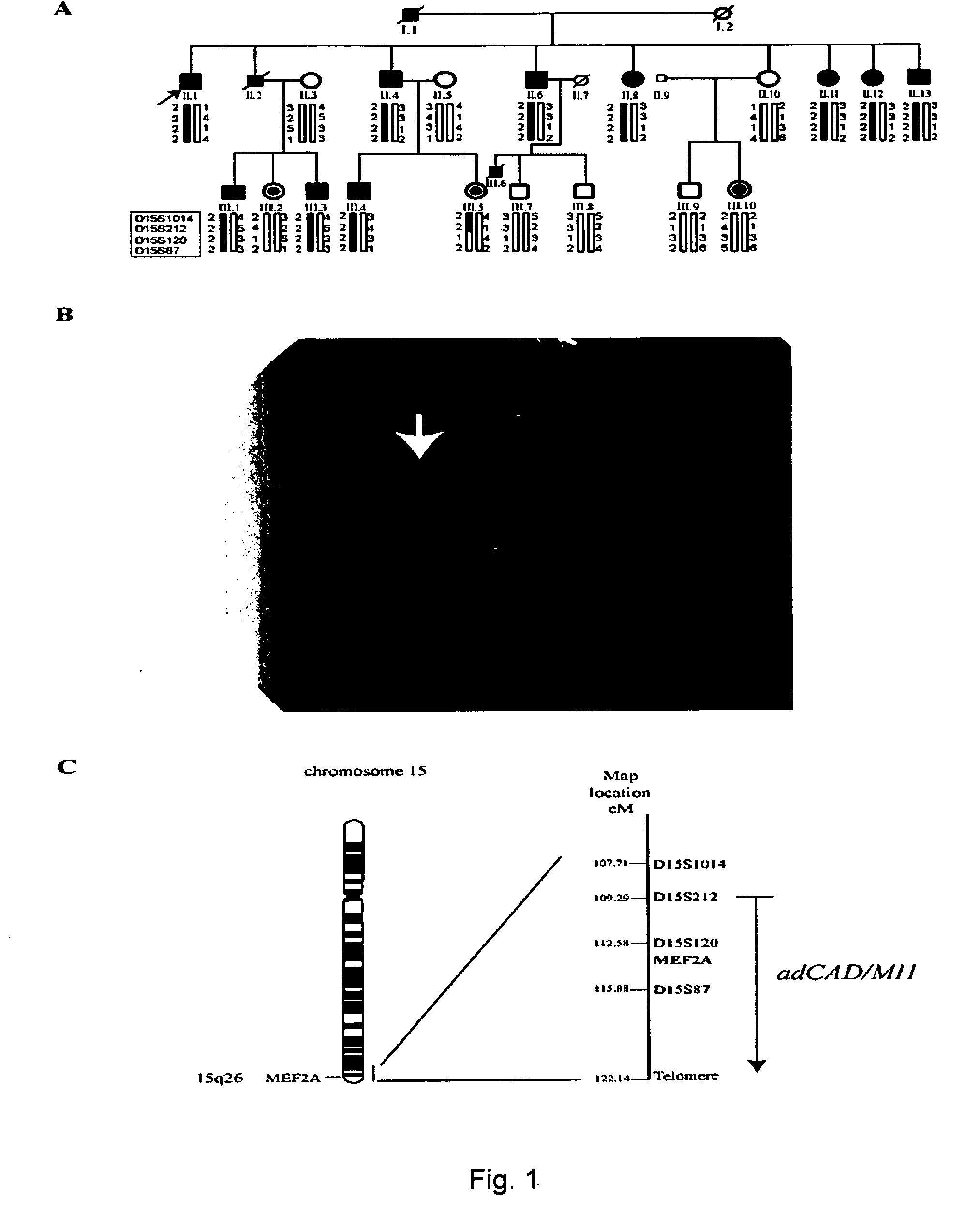 Pathogenic gene for coronary artery disease