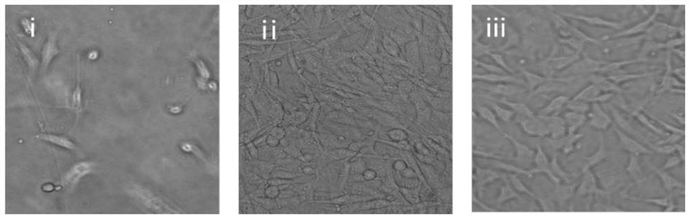 A photopolymerizable color gel with self-feedback hardness distribution and its preparation method and application