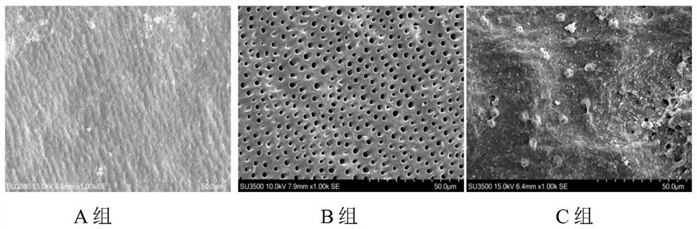 Dentin desensitization paste based on biomimetic remineralization principle and preparation method of dentin desensitization paste