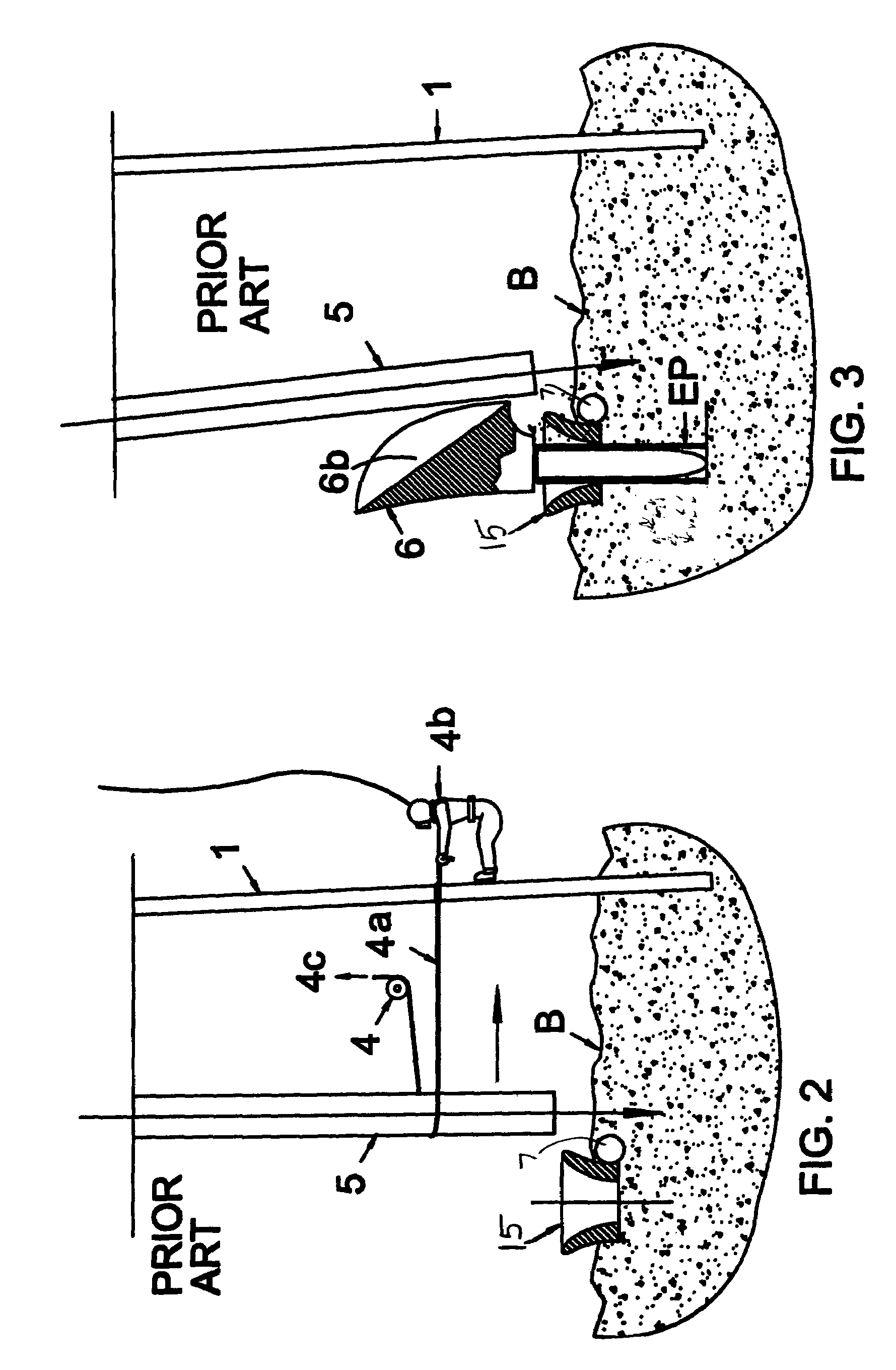 Conductor pipe string deflector and method