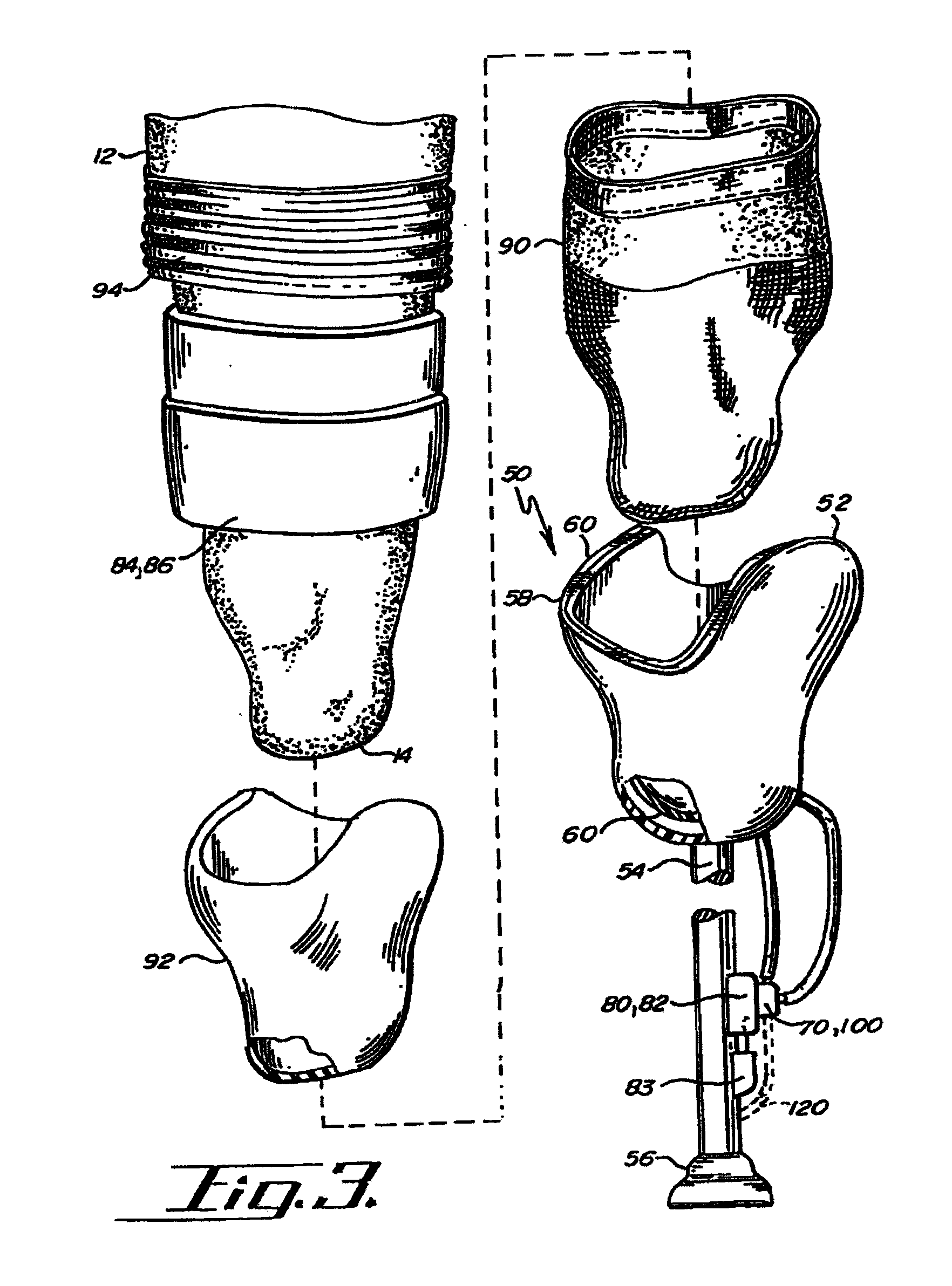 Socket liner for artificial limb
