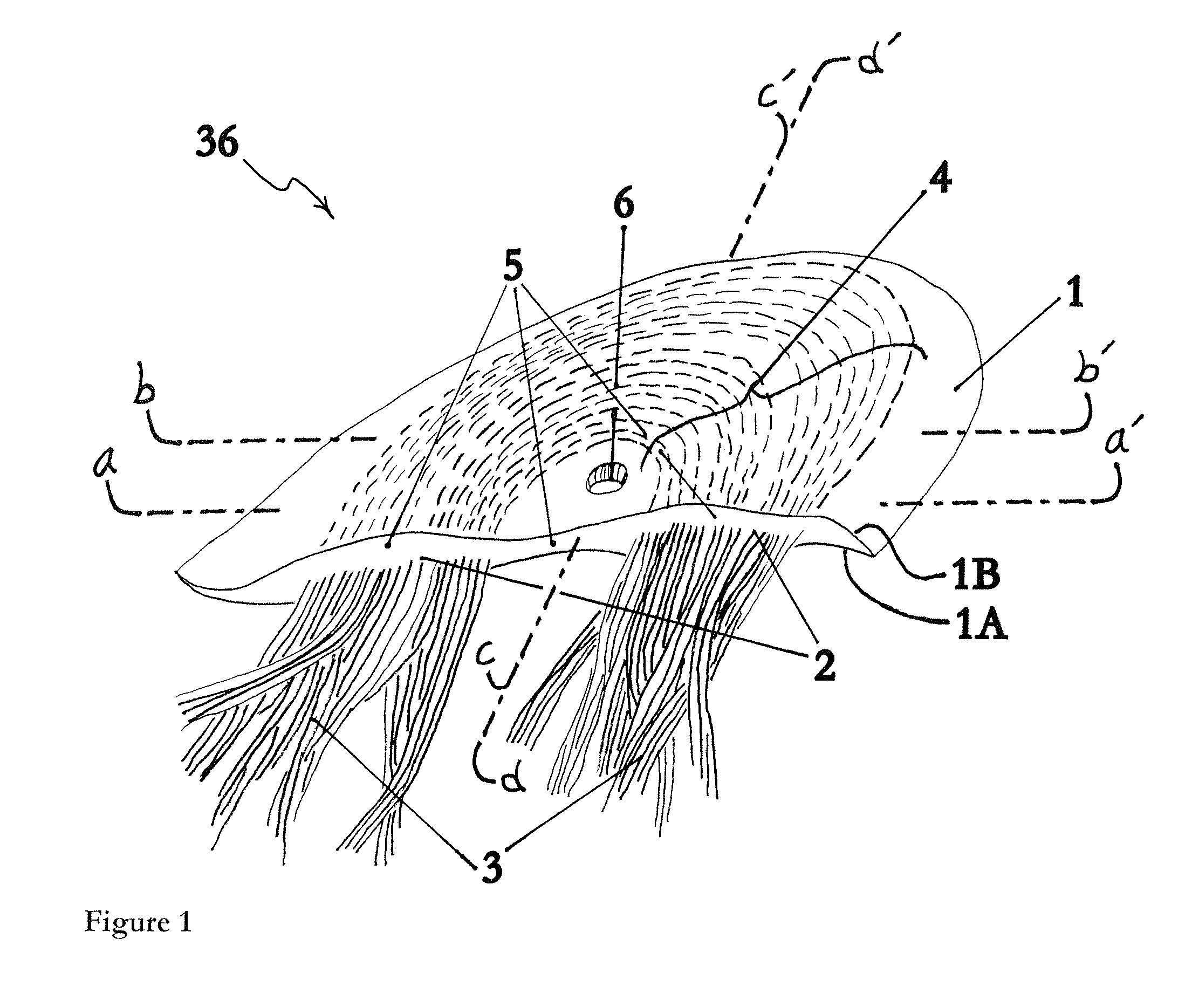 Prosthetic anchor and method of making same