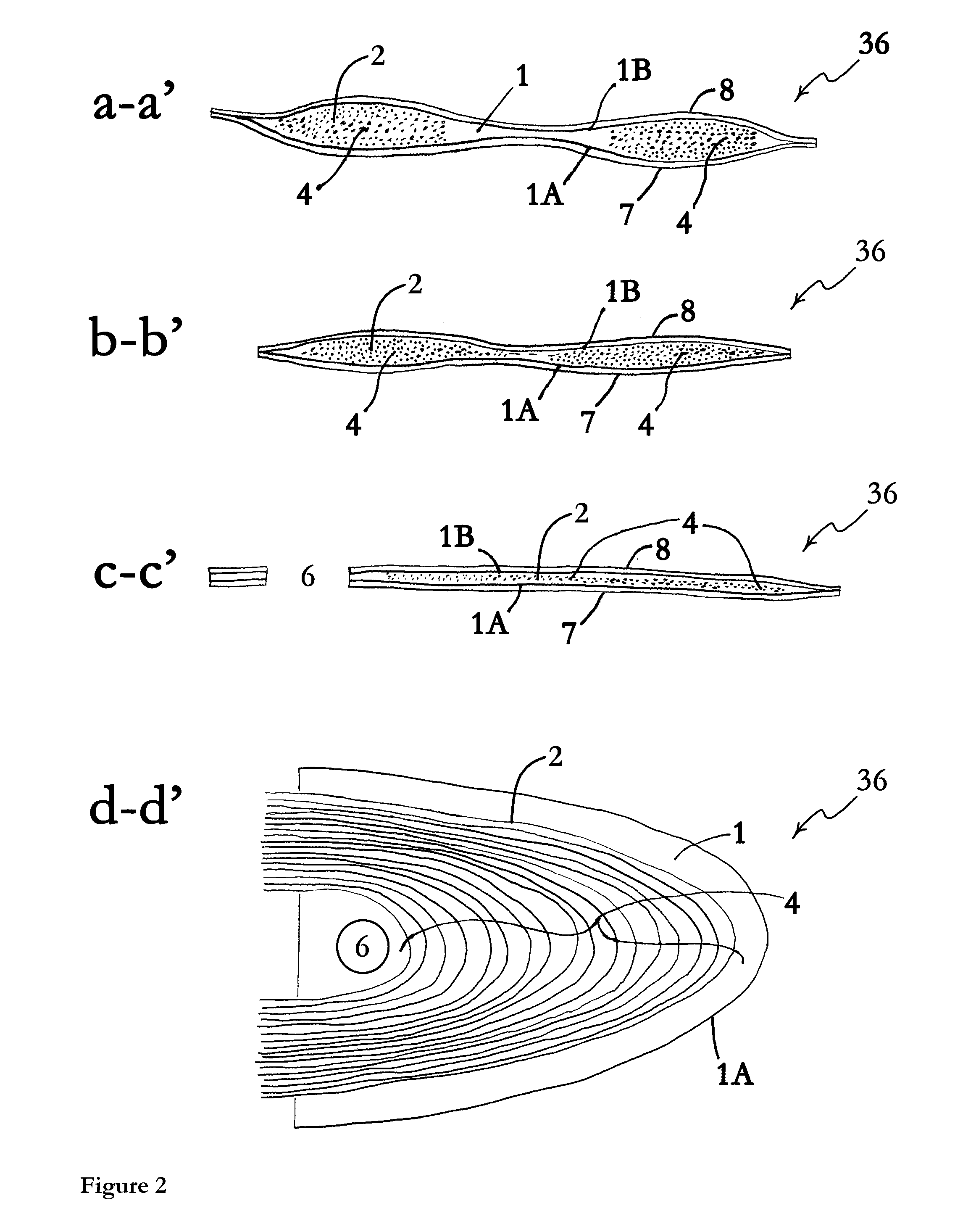 Prosthetic anchor and method of making same