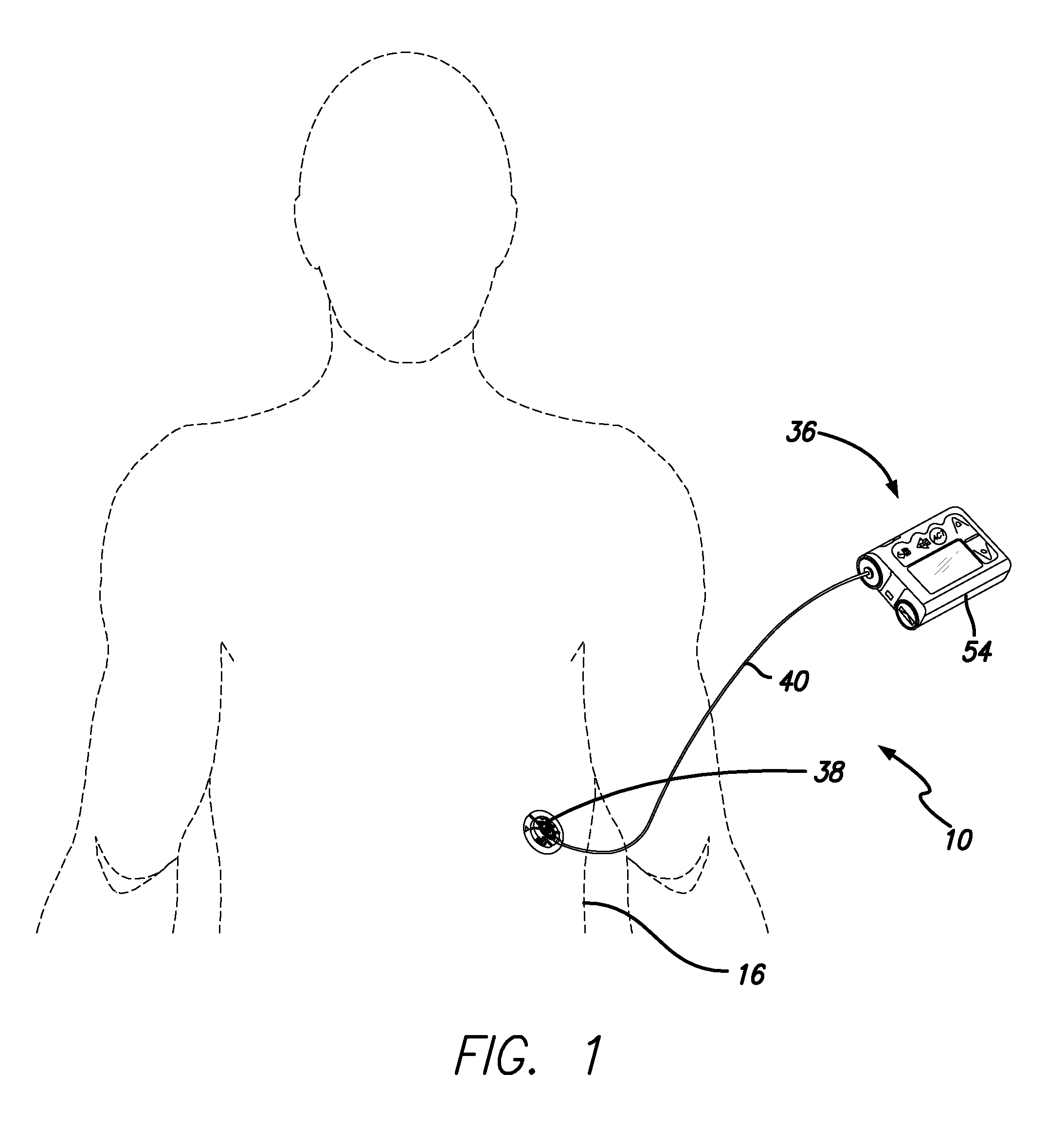 Priming detection system and method of using the same