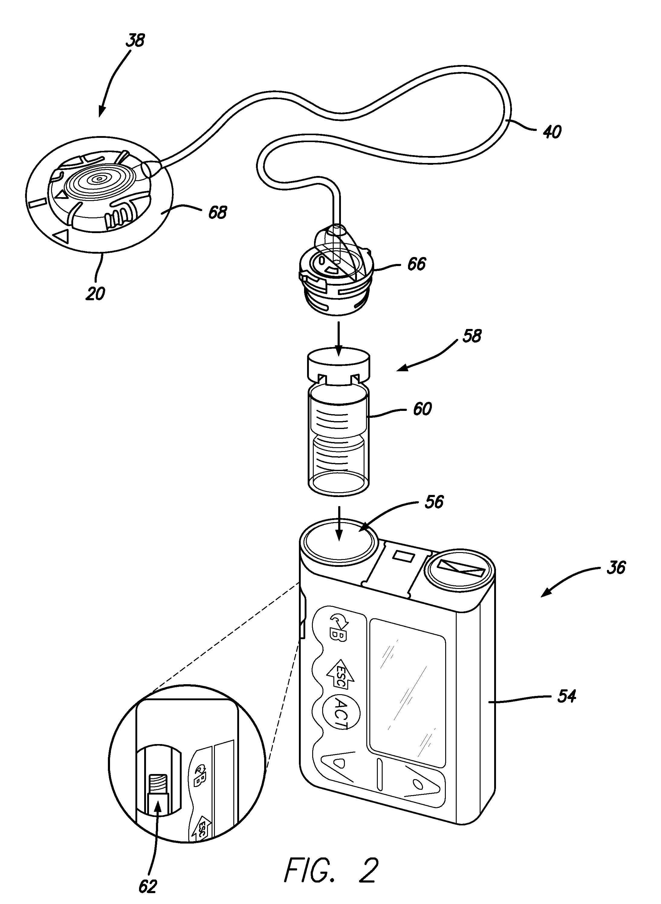 Priming detection system and method of using the same