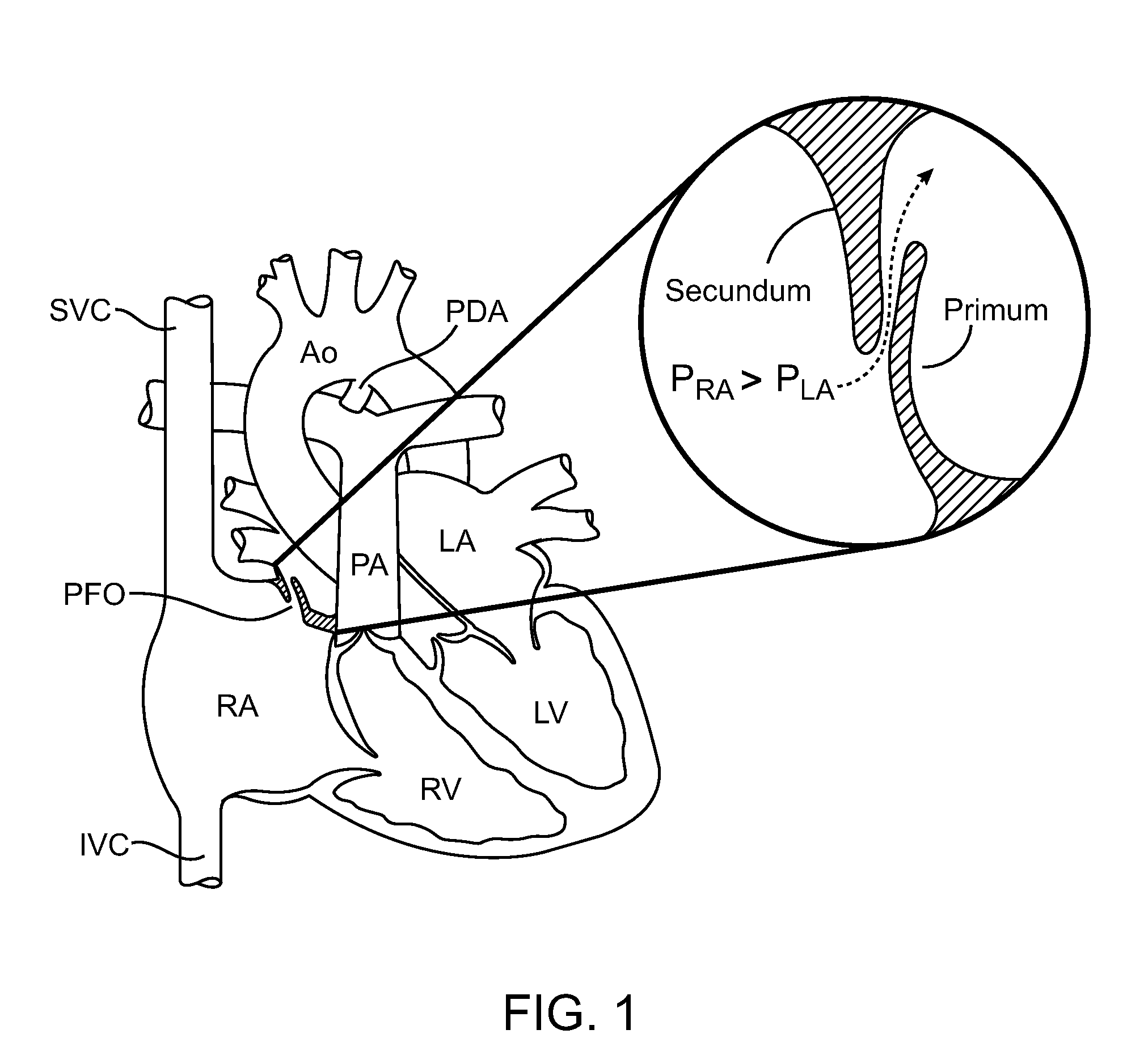 Multi-electrode apparatus for tissue welding and ablation
