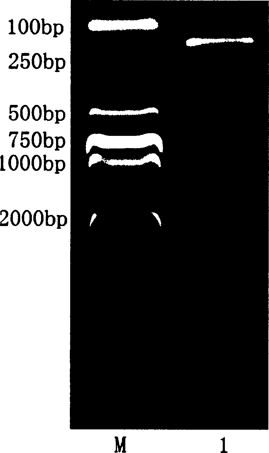 Method for detecting giardia by pyrosequencing technology