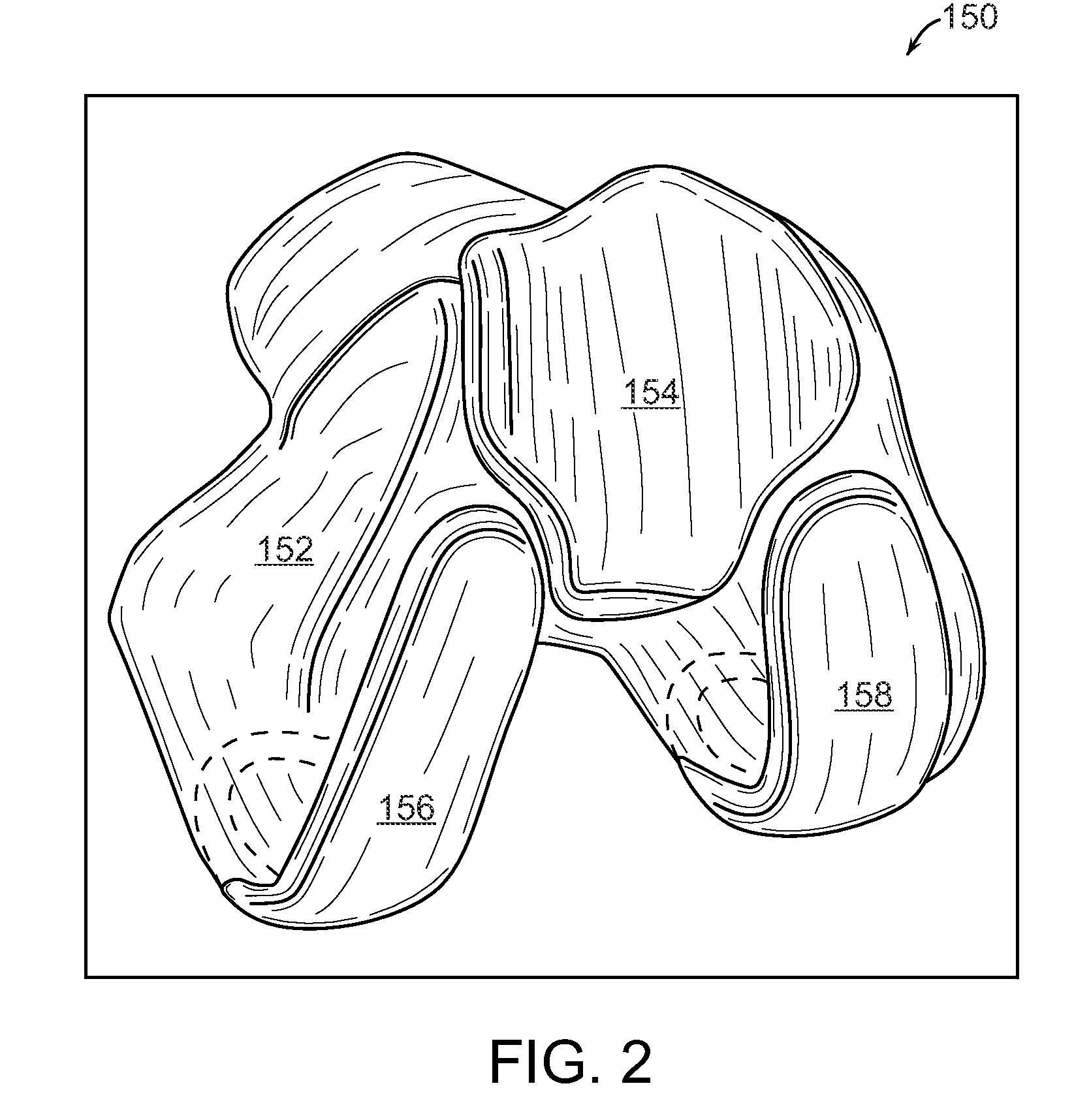 Implant planning for multiple implant components using constraints