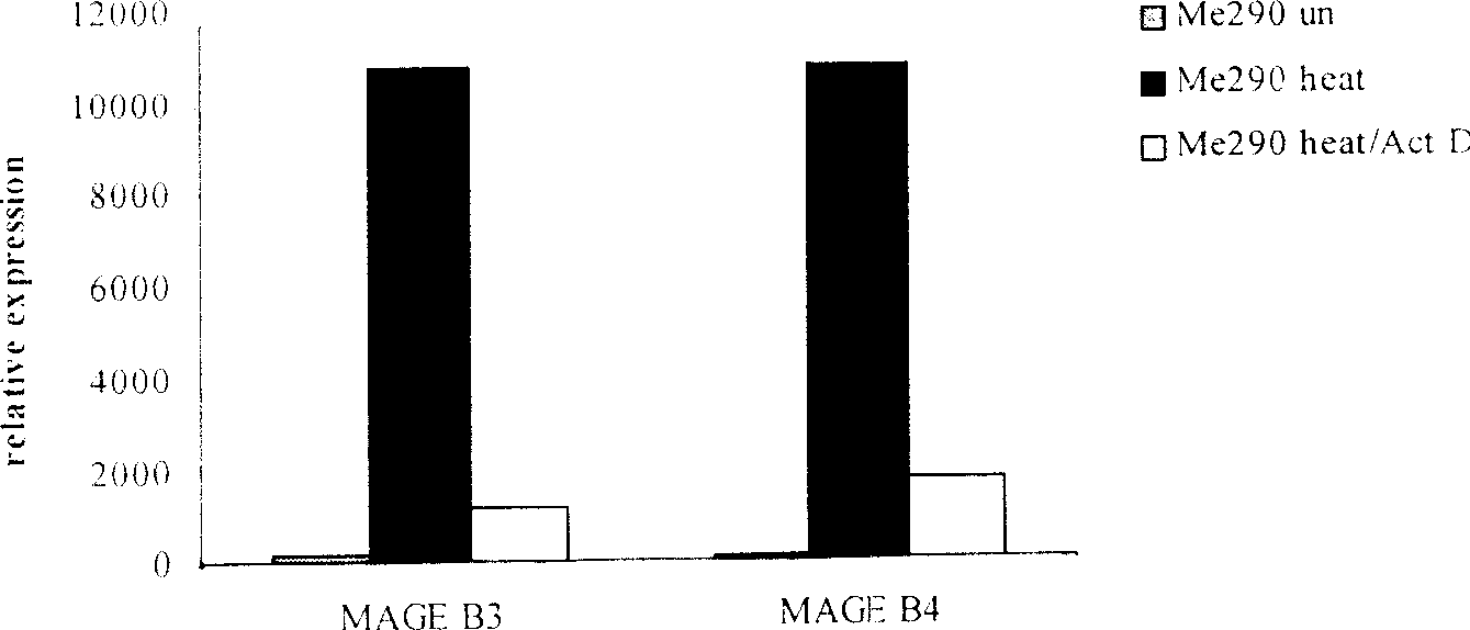 Dendron shaped cell tumour vaccine for loading withered heat shock tumour cell, its preparation method and application