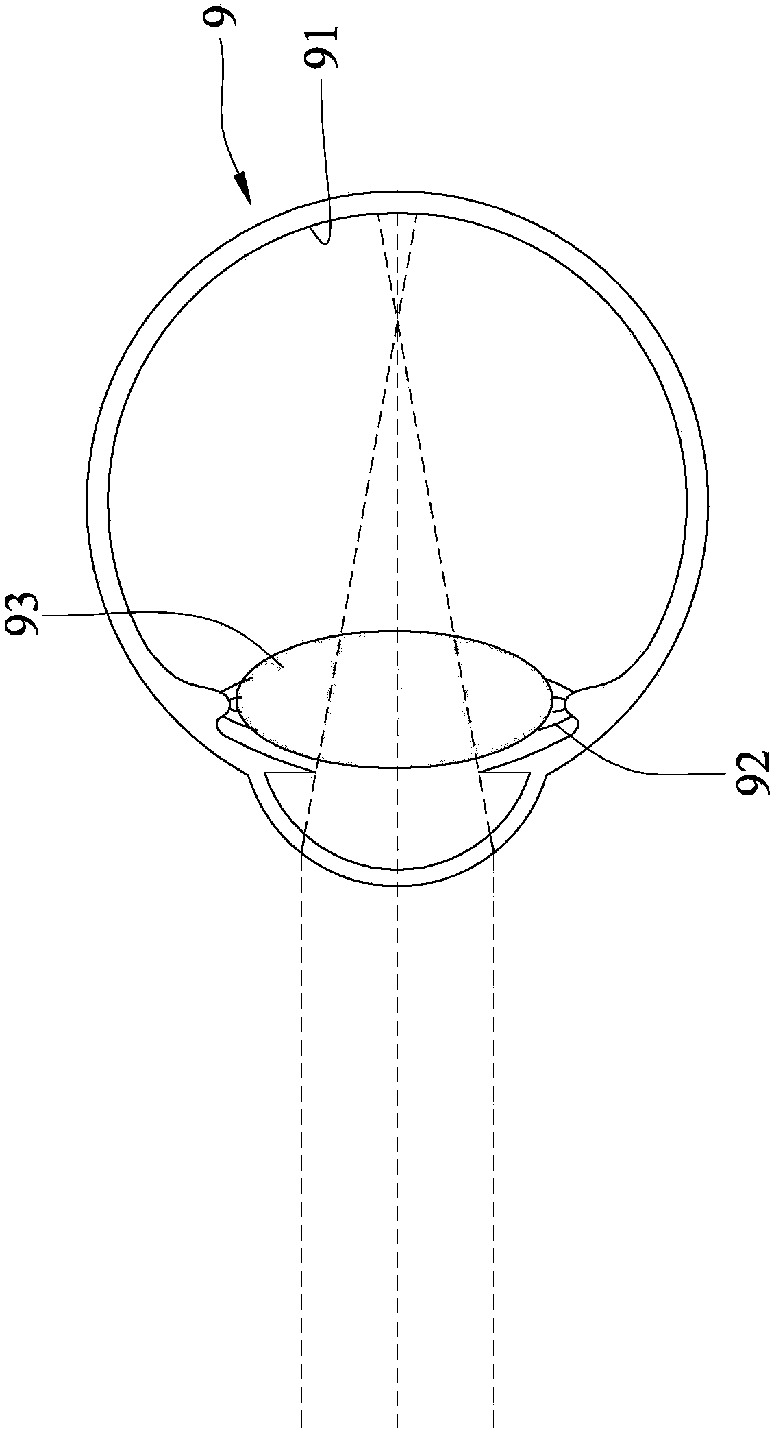 Continuous zooming contact lens