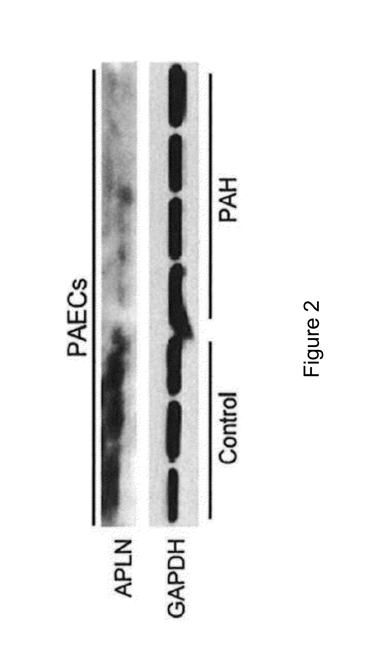 Compositions and Methods of Using Micro RNAs