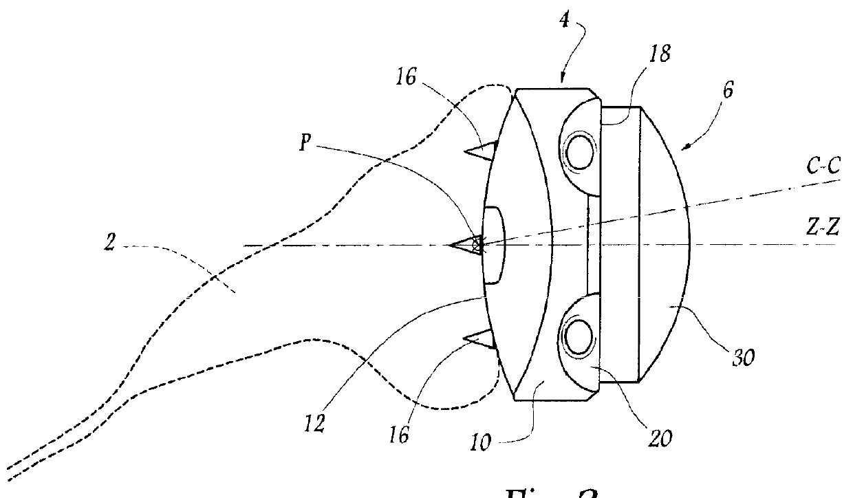 Ancillary tool for positioning a glenoid implant