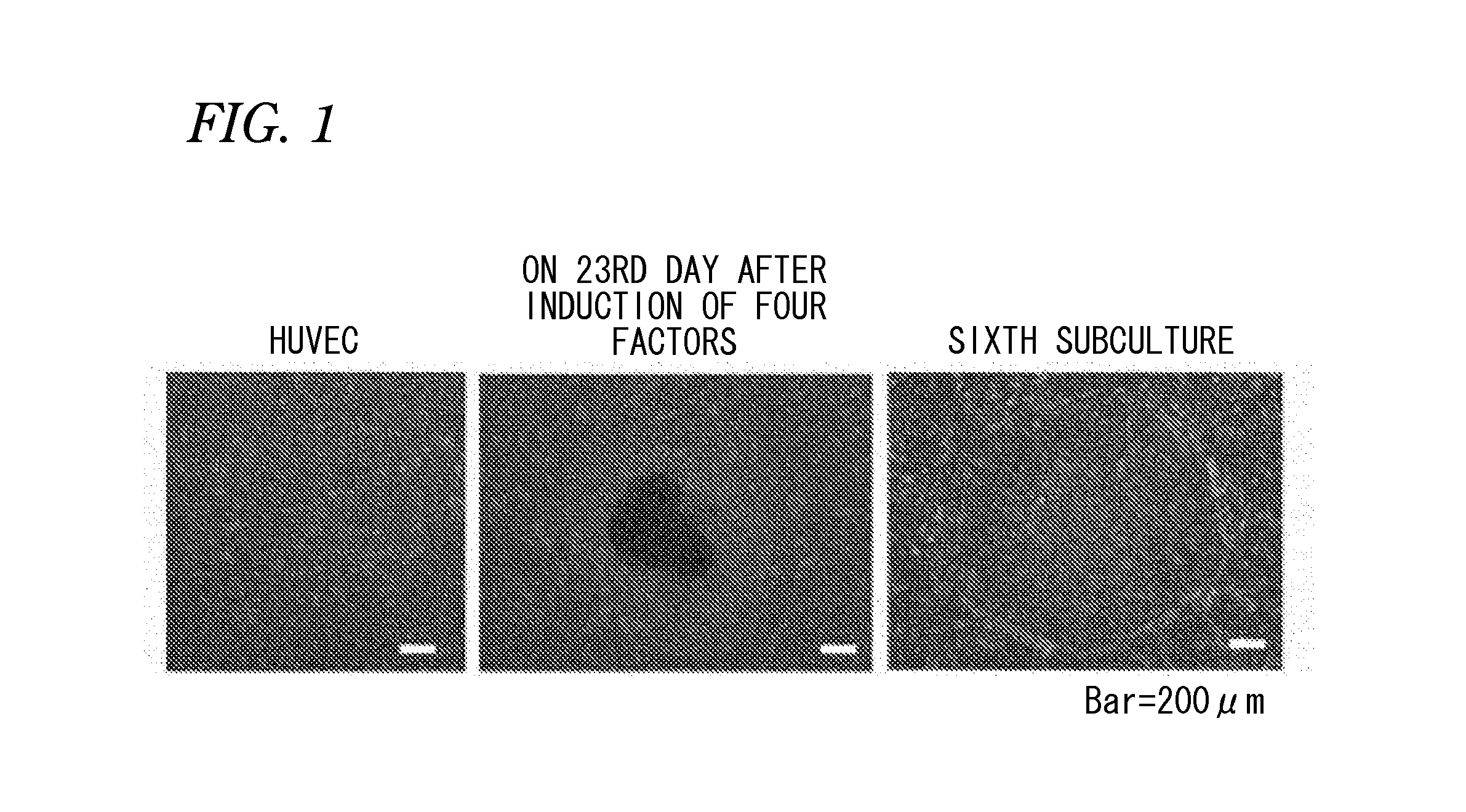 Pluripotent stem cell-derived brown adipocytes, pluripotent stem cell-derived cell aggregate, method for producing same, and cell therapy and medical therapy therefor