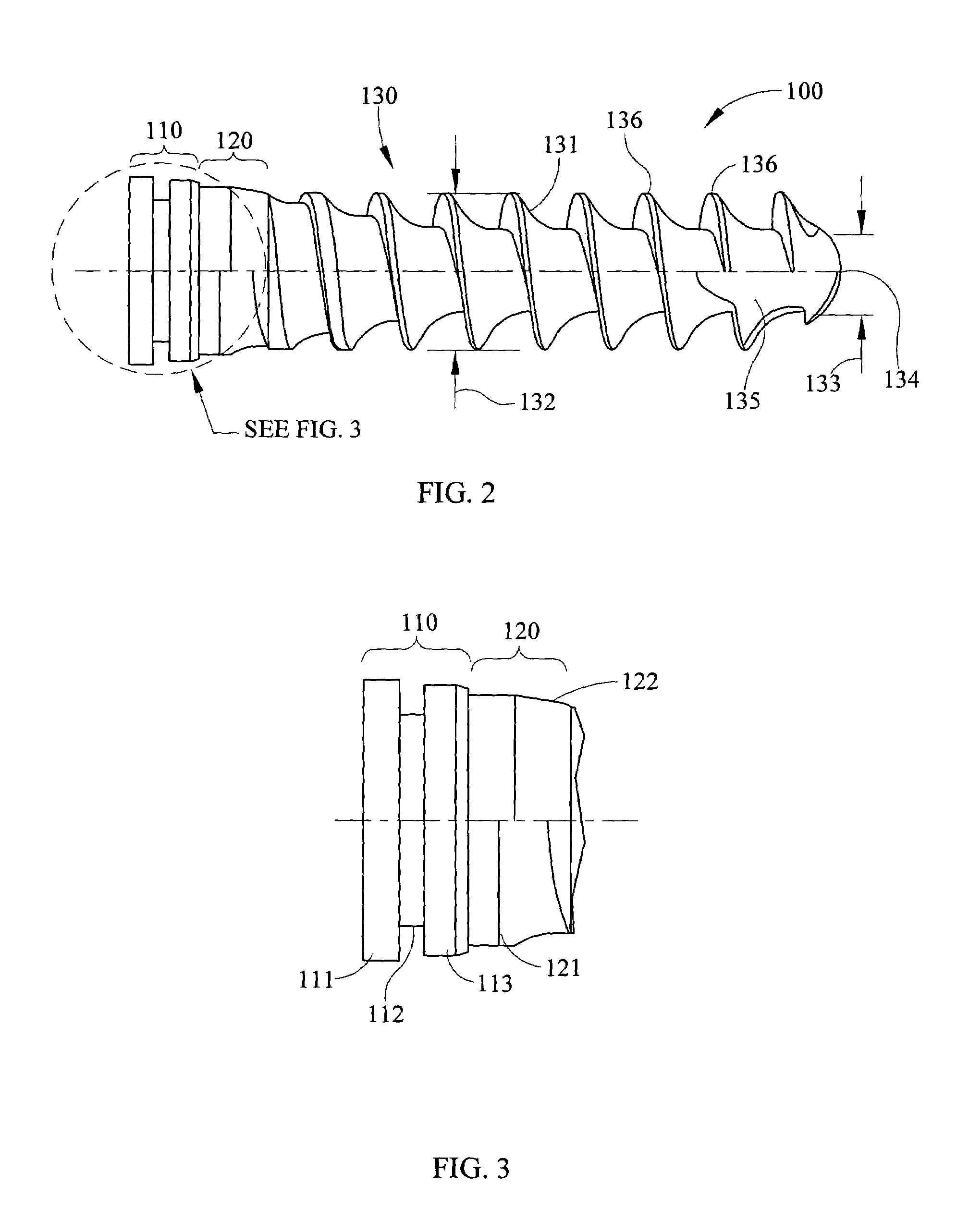 Fixed and variable locking fixation assembly