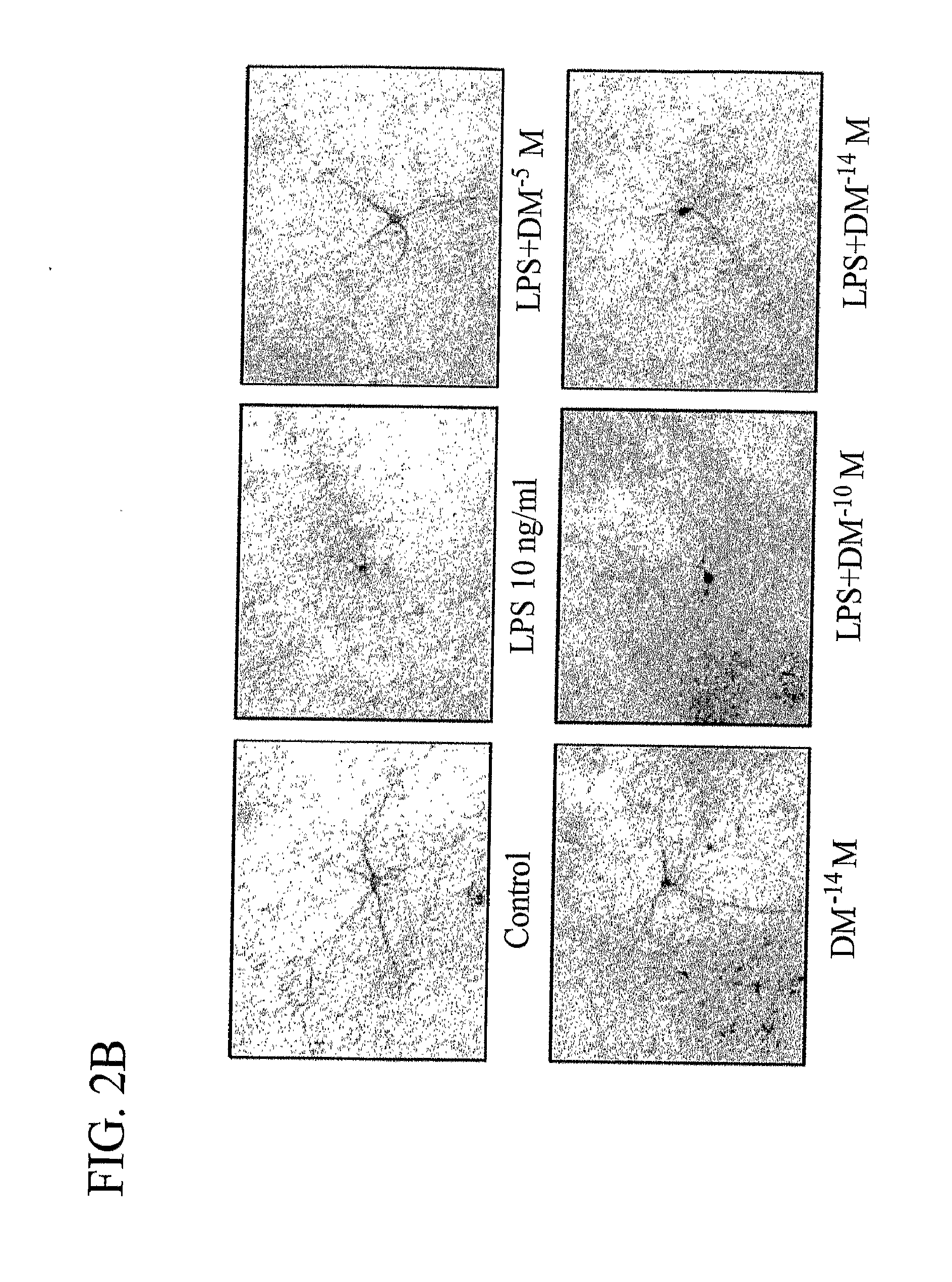 Methods related to the treatment of neurodegenerative and inflammatory conditions