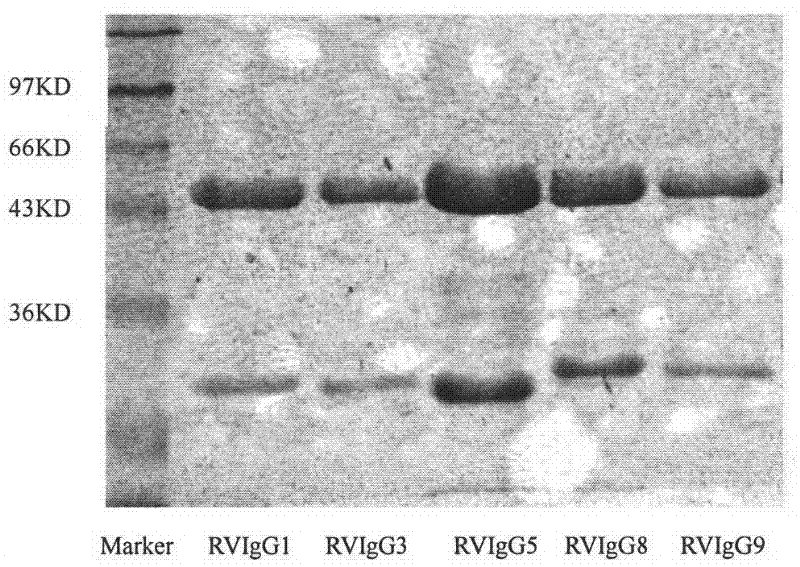 Humanized neutralizing antibody (RVFab5) against rabies virus glycoprotein