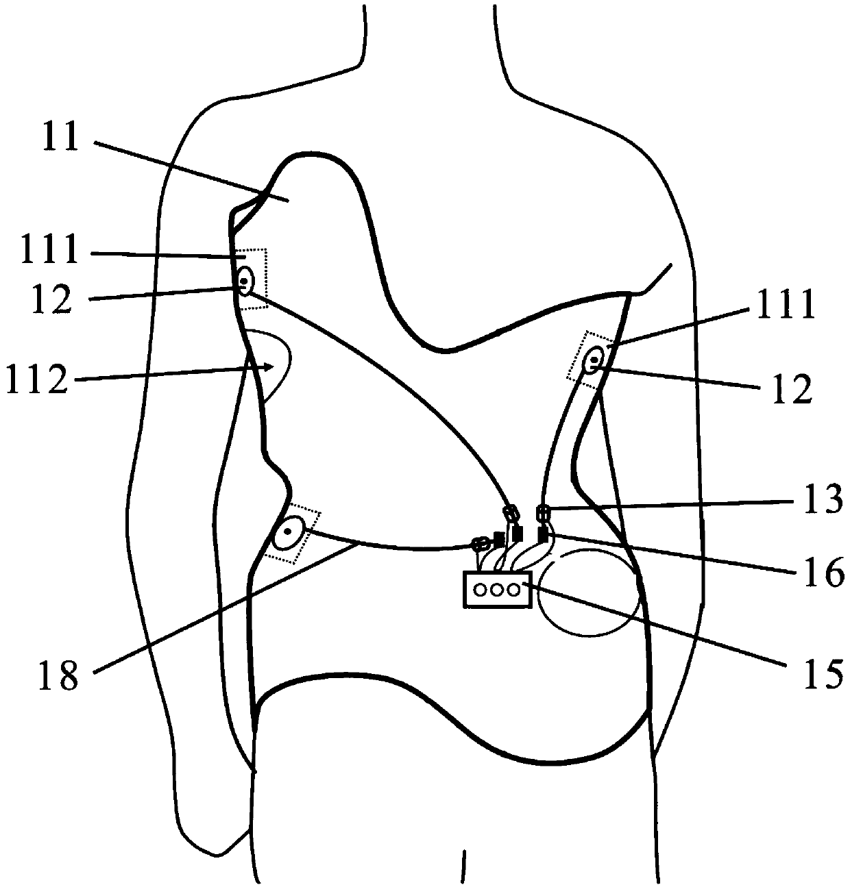 Intelligent scoliosis orthopedic system and control method