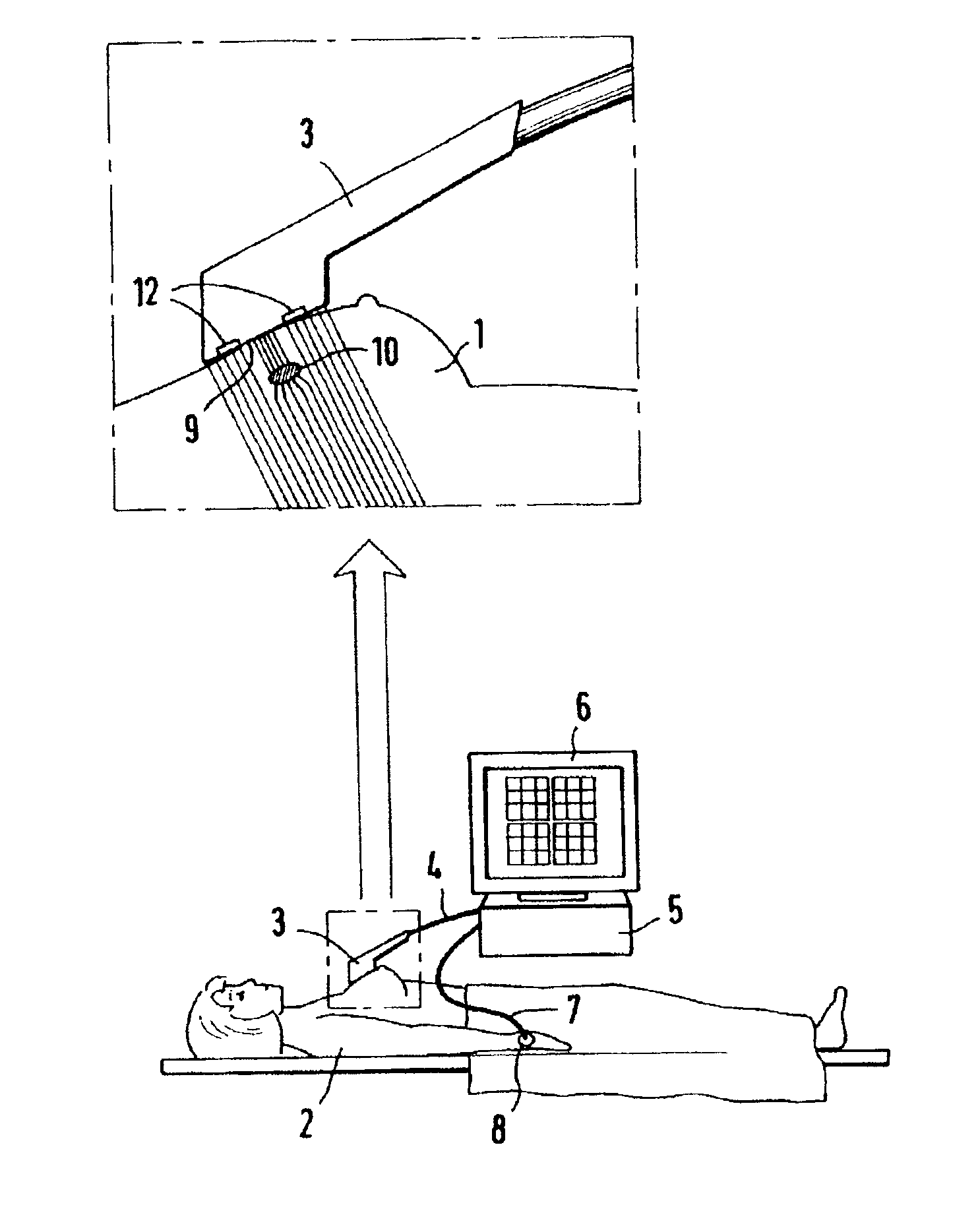 Combined electrical impedance and ultrasound scanner