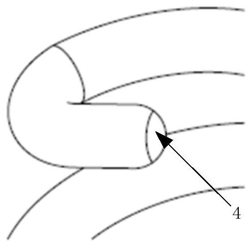 Degradable magnesium metal nail for patch fixation and use method