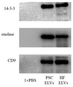 Non-coding RNA expression profile analysis method for echinococcus granulosus protoscolex derived exosomes and cyst fluid derived exosomes and non-coding RNA sequences