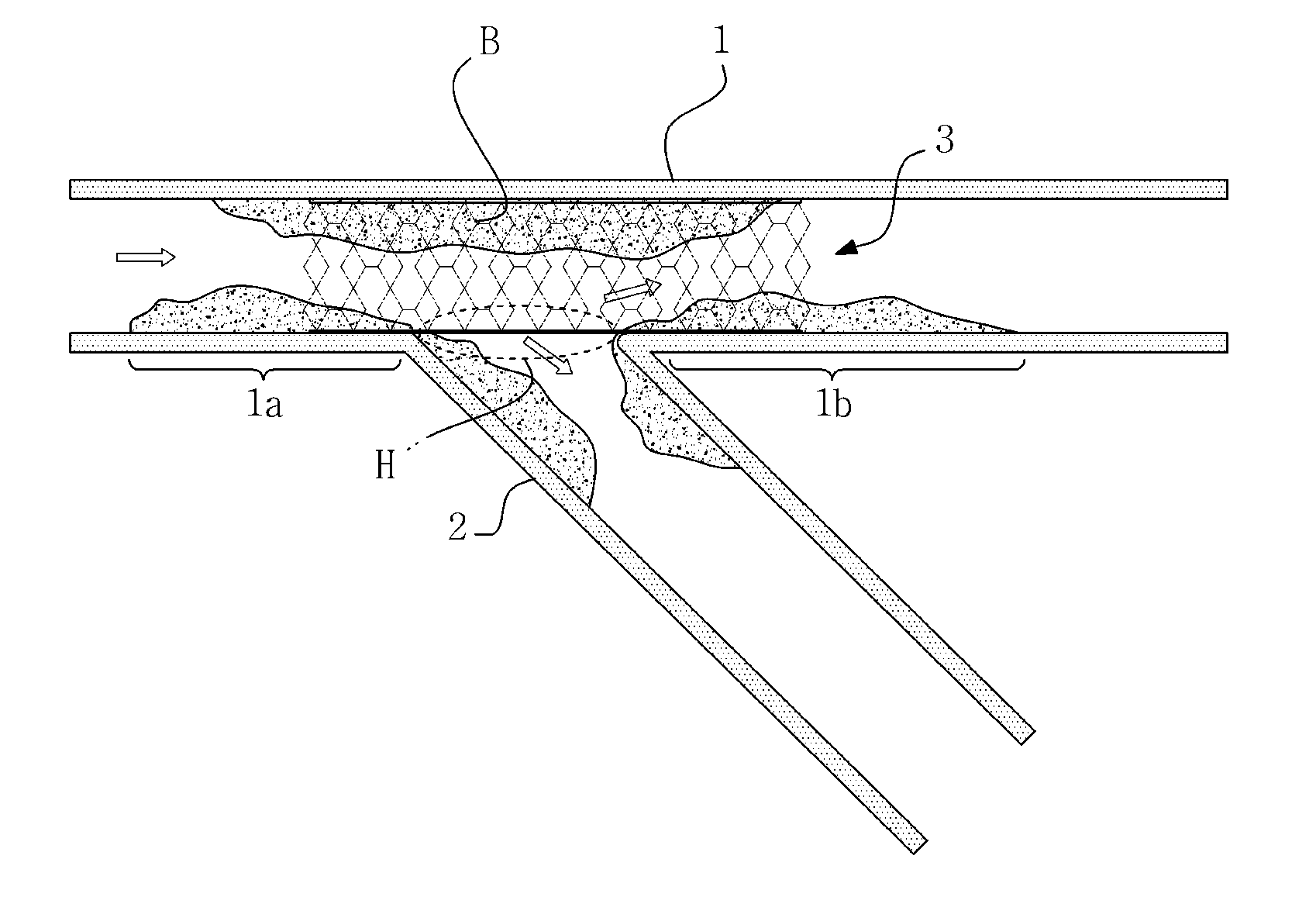 Stent for protecting bifurcated blood vessels in bifurcation lesion