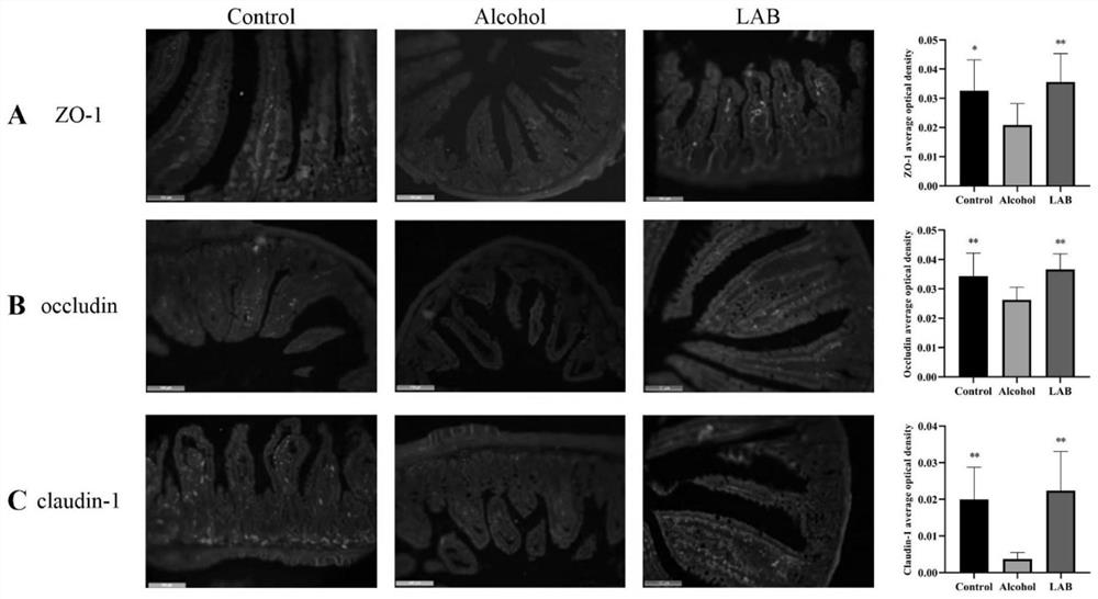 A lactic acid bacteria formula for preventing acute and chronic alcoholic liver injury and its application