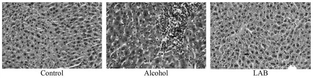 A lactic acid bacteria formula for preventing acute and chronic alcoholic liver injury and its application