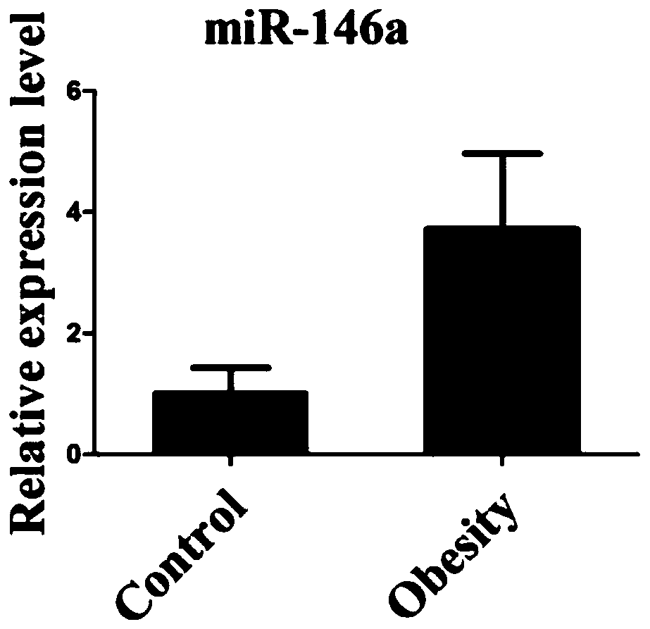 A serum or plasma miRNA marker associated with childhood obesity and its application